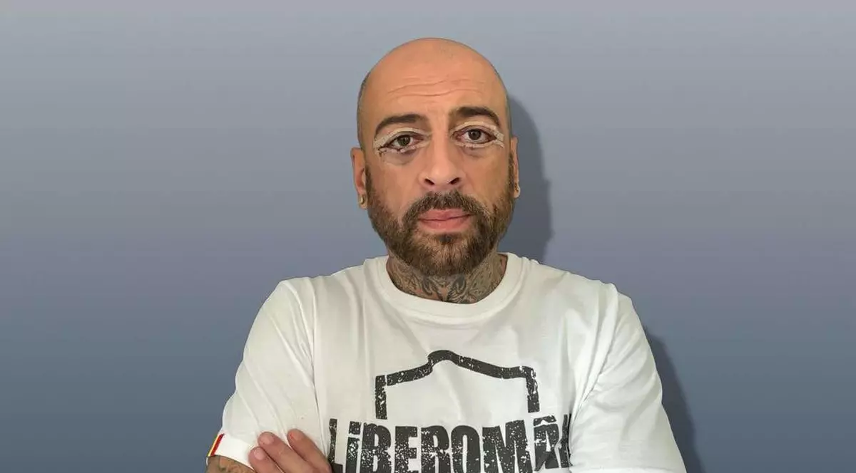 Imagini cu CRBL după ce și-a făcut prima operație estetică la față. Fanii au reacționat: „În locul tău mi-aș face și un baby botox în frunte”