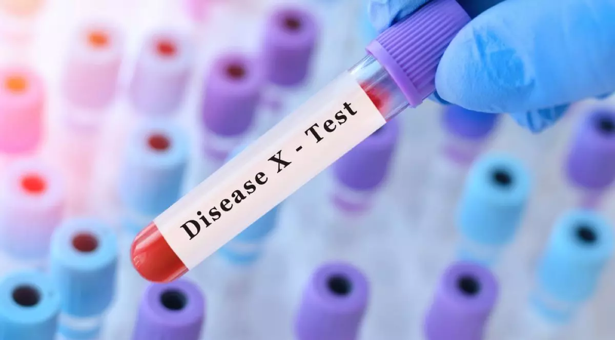 Ce este Boala X - simptome