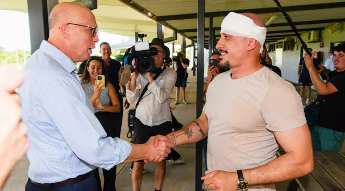 Liderul opoziției din Australia i-a spart capul unui cameraman, după ce l-a lovit din greșeală cu o minge de fotbal australian