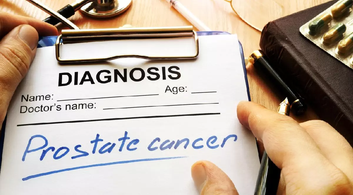 Un test cu salivă ar putea schimba lupta împotriva cancerului de prostată