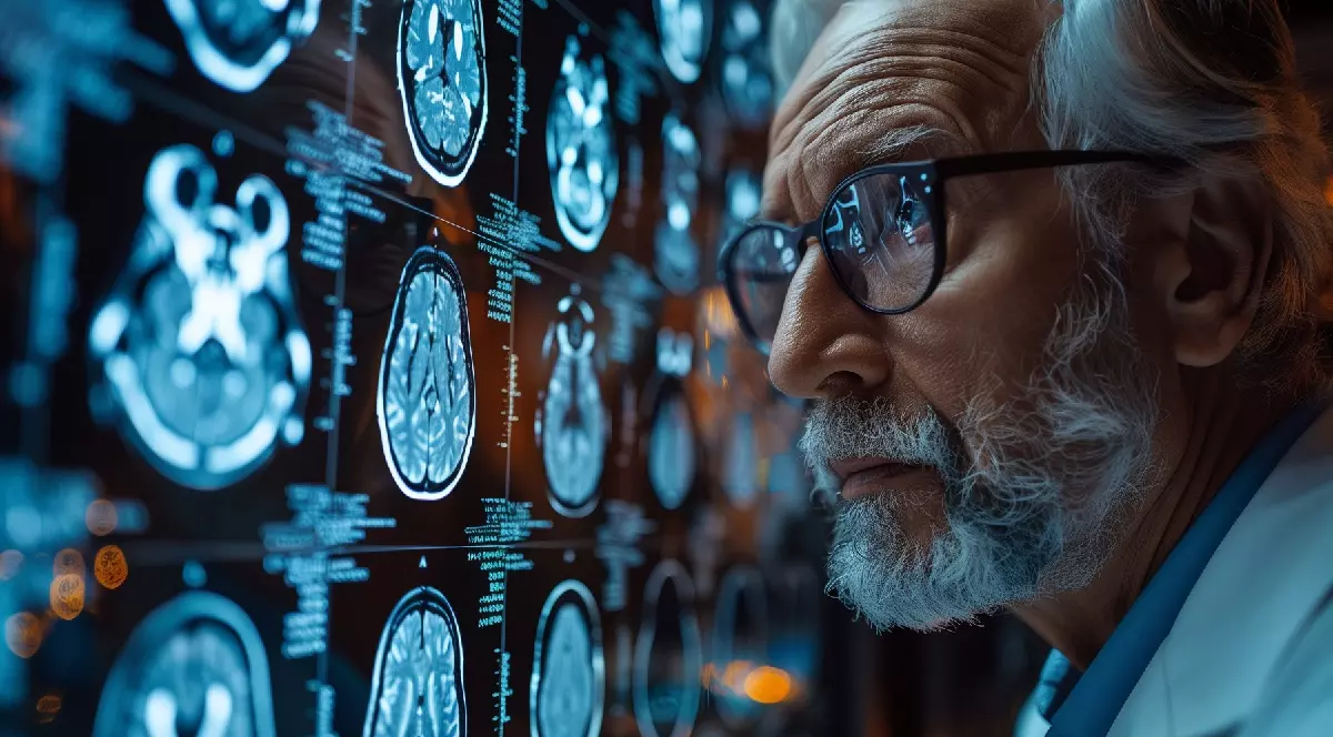 un doctor care se uita la o radiografie la creier