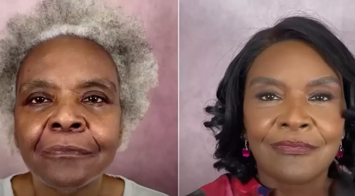 Imaginea prezintă un colaj „înainte și după” al unei femei în vârstă, care arată o transformare remarcabilă în urma unor intervenții estetice.