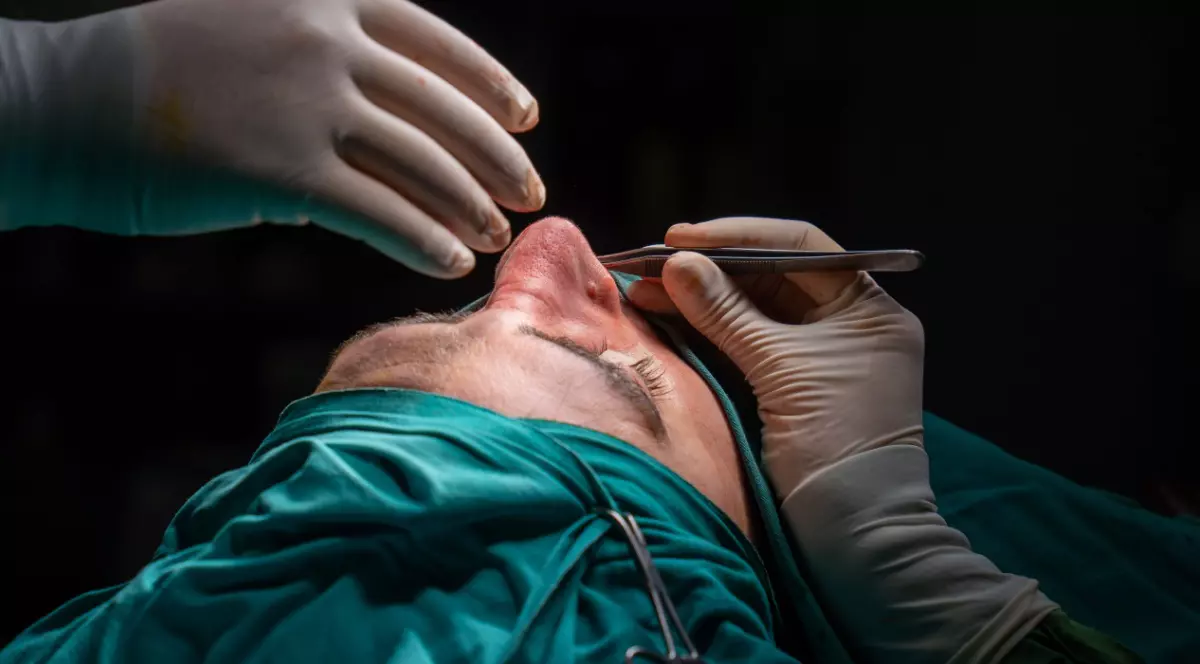 Pacient sub anestezie inainte de operatie rinoplastie