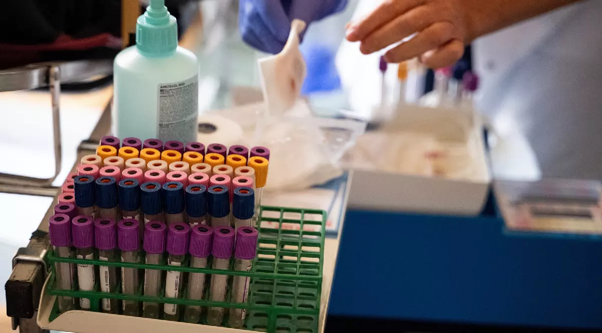 Mai multe eprubete cu teste de sânge sunt așezate pe masa unui laborator, în dreapta se observă mâna unui medic care urmează să le manipuleze