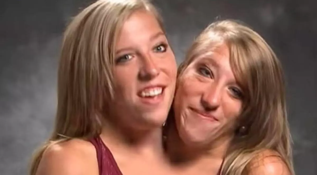 Imagine cu Abby și Brittany Hensel
