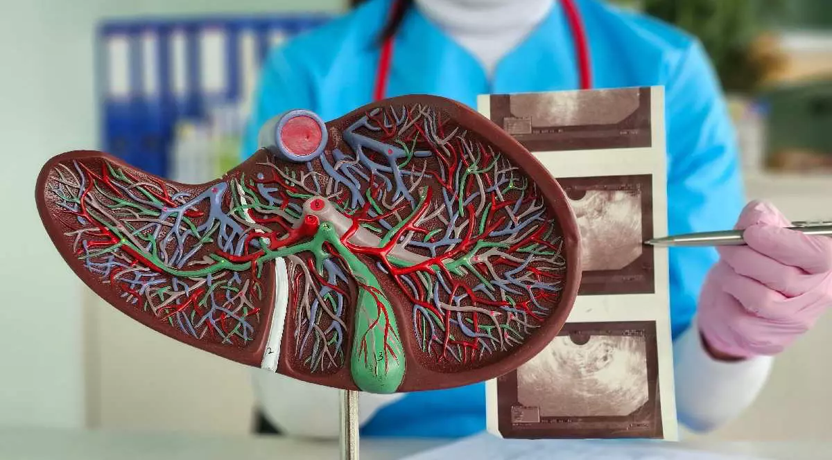 Un medic examinează un model de ficat împreună cu imagini cu ultrasunete