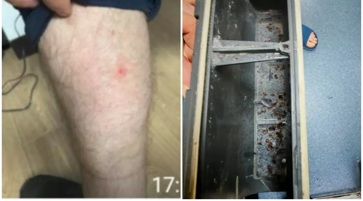 Bărbat mușcat de ploșnițe în partea stângă. În partea dreaptă sunt mai multe ploșnițe în sediile Poliției Capitalei