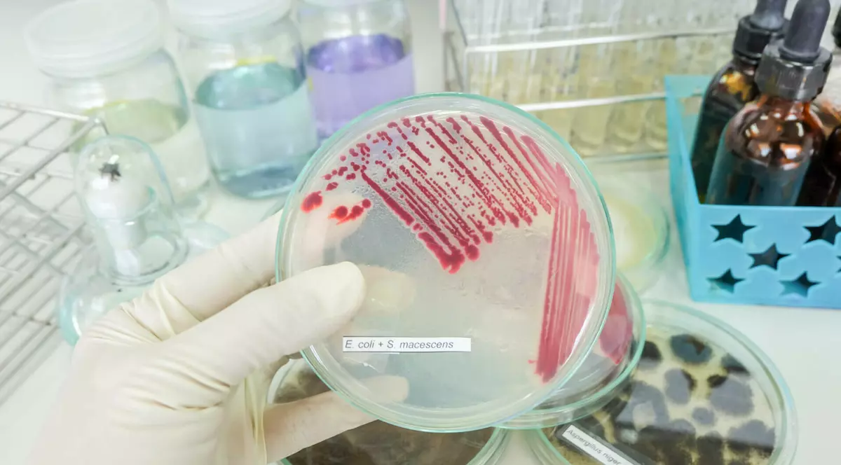 (P) Infecțiile spitalicești nu trebuie să mai ucidă: apel pentru implementarea tehnologiilor moderne în România