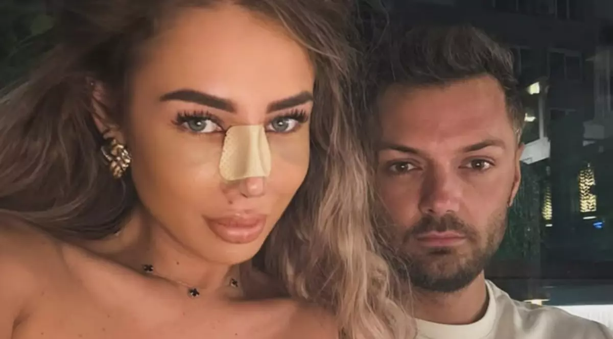 Maria Avram s-a operat la nas