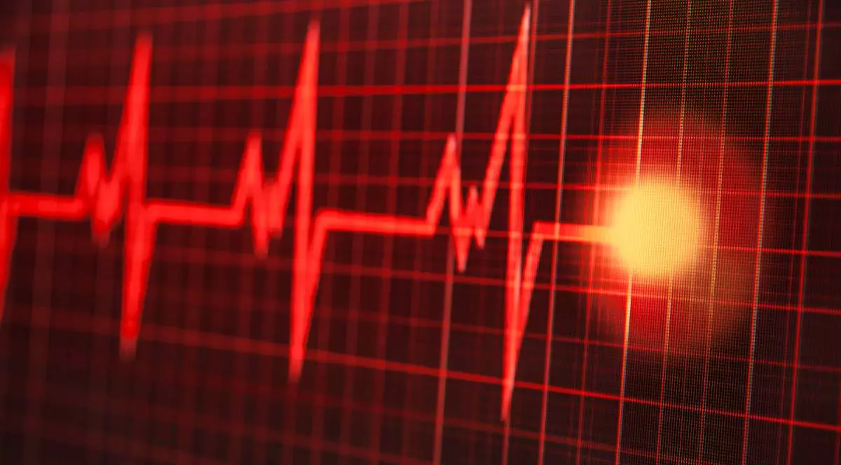 Bataile inimii pe un monitor EKG, linie cardiacă