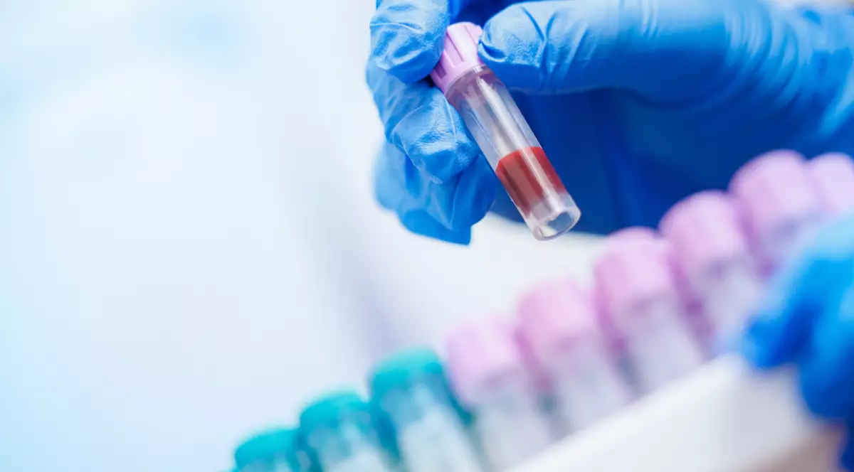 O persoană care poartă mănuși albastre și ține în mână un test de sânge.