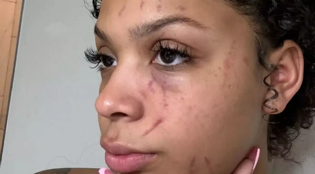 Acuzații grave de violență domestică împotriva vedetei NFL Rashee Rice: „Am obosit să mai tac”