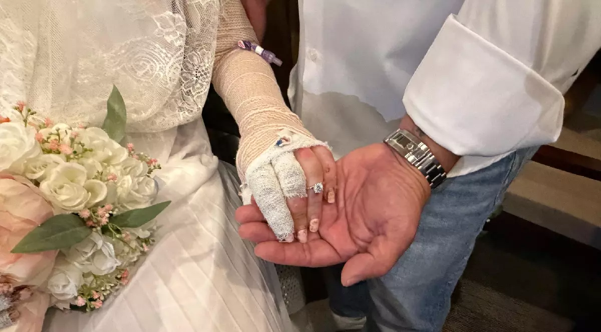 Un spital din Florida a organizat nunta unei paciente cu arsuri grave suferite într-un accident la grătar