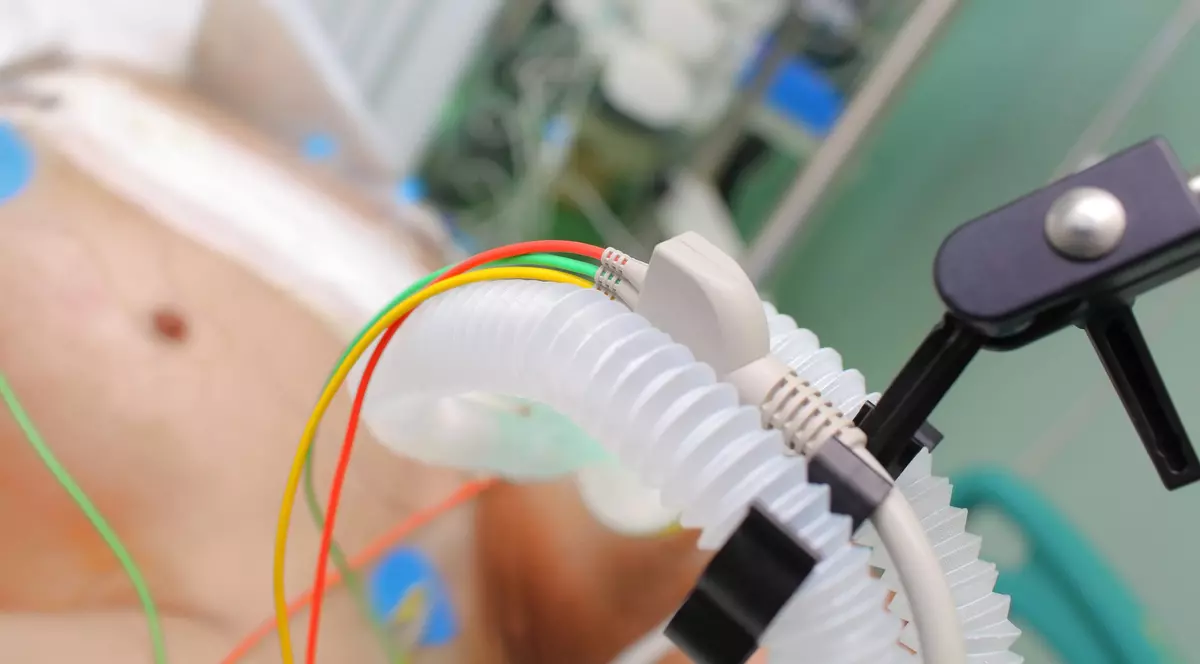 Echipament pentru susținerea vieții pacientului spitalizat. Imagine cu caracter ilustrativ.