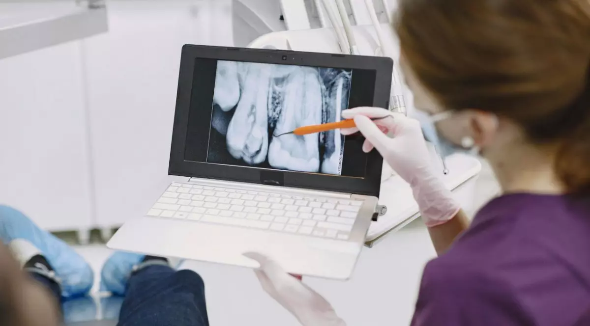 Implant dentar în 2026: ce influențează costul și ce ar trebui să știi înainte de tratament