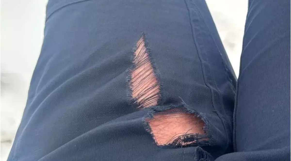 Pantaloni albaștri rupți în partea stângă.