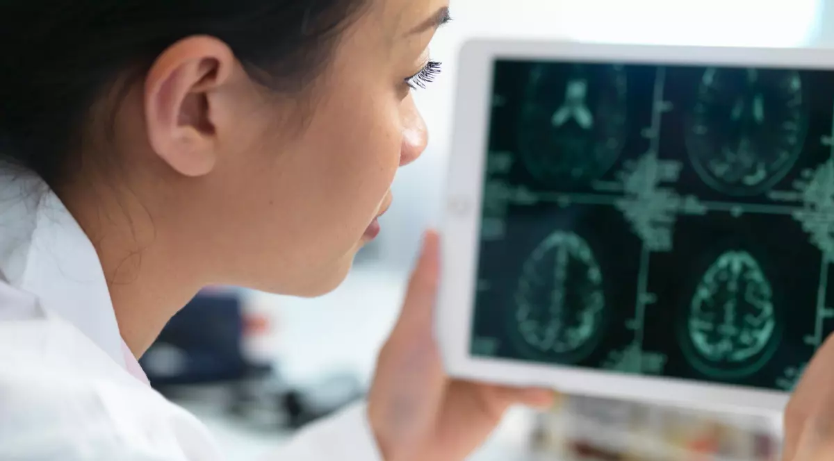 Un doctor care analizează o tomografie a creierului.
