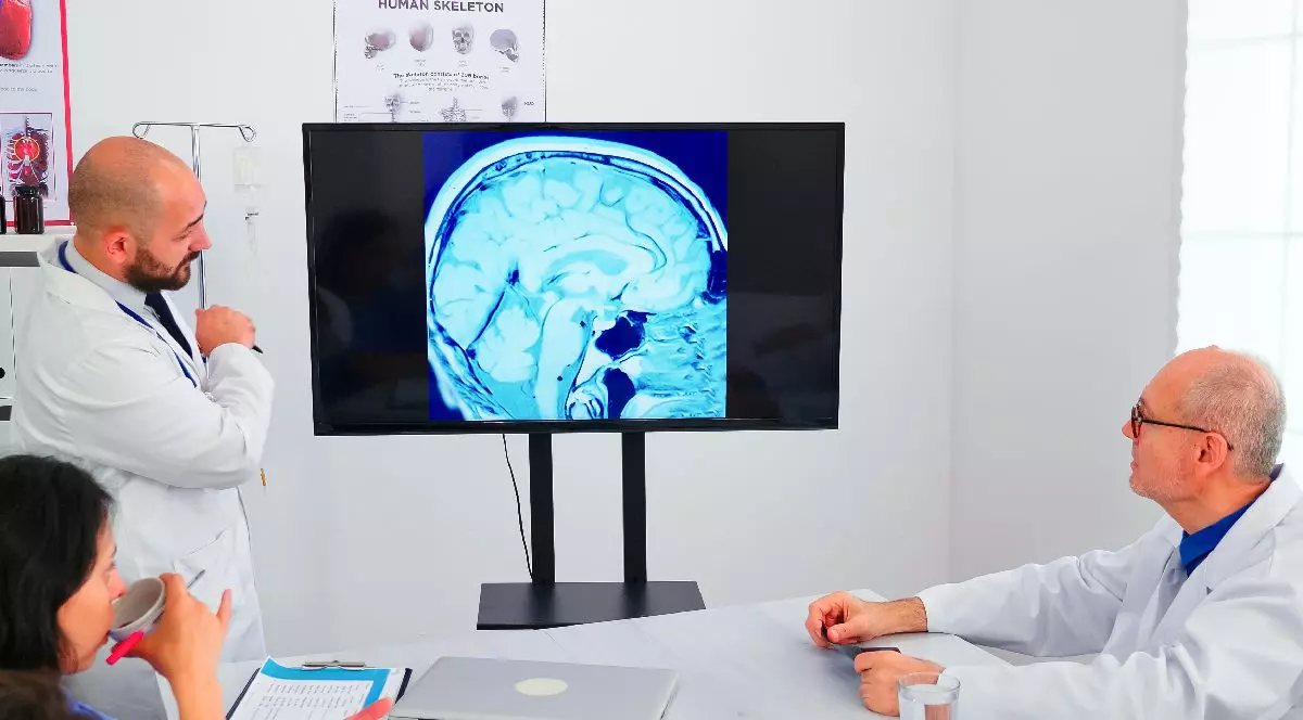 Intr-un cabinet medical, 3 medici se uita la un creier pe ecran. DBS, tehnologia care repara creierul pacientilor cu distonie