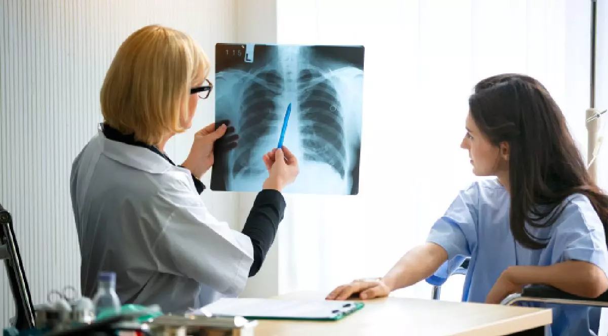 Intr-un cabinet un medic femeie in halat alb priveste o radiografie pulmonara si o alta femeie priveste. Cancer pulmonar, nefumatori, poluare