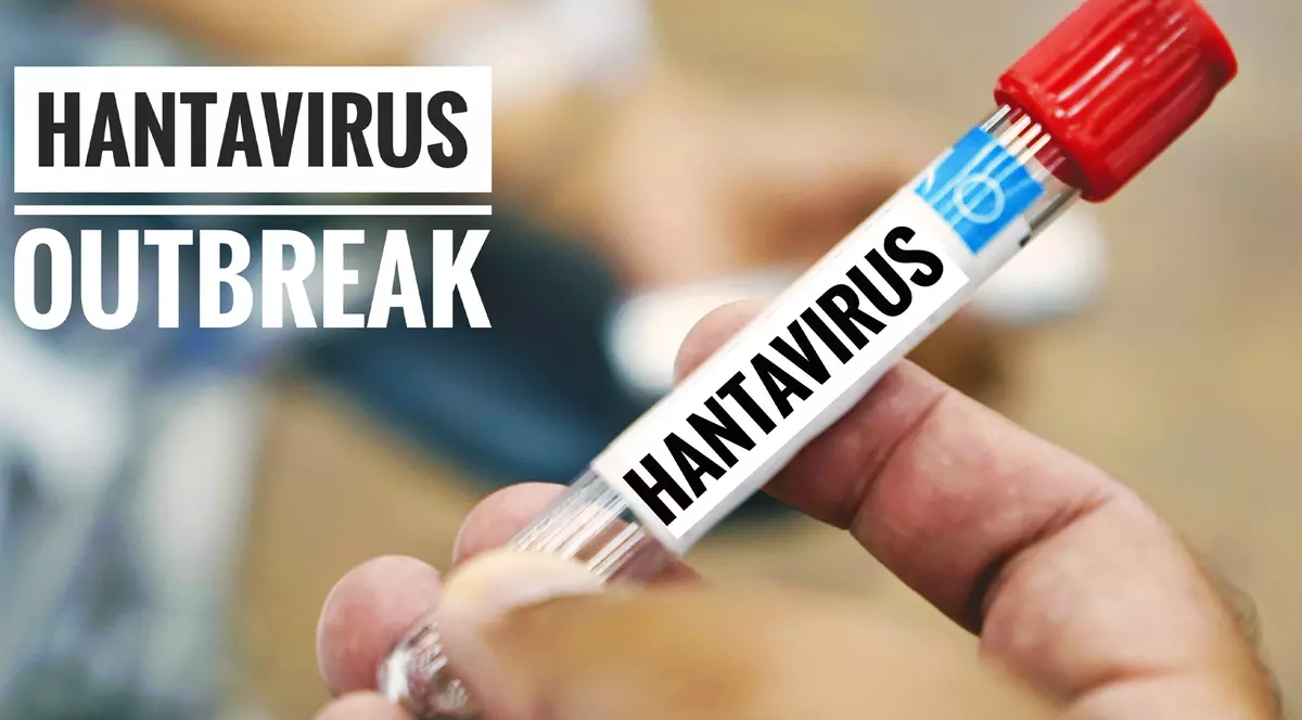 In maini tine un test pentru Hantavirus