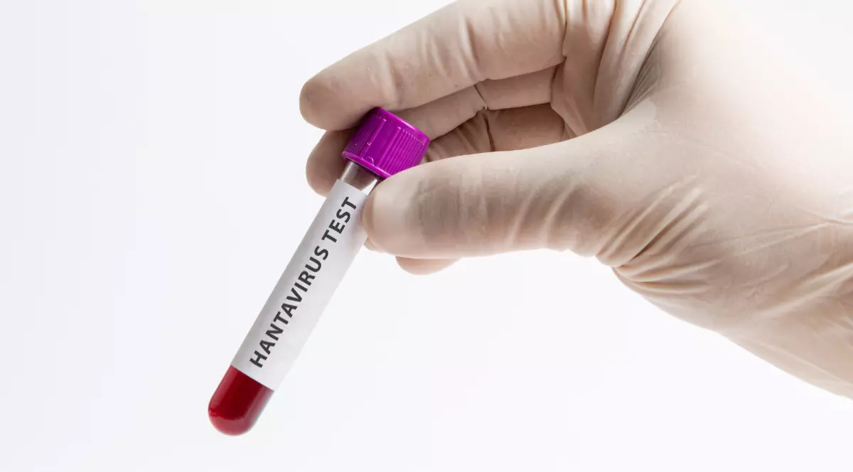 O femeie care poartă mănuși medicale și ține în mână o epubretă pe care scrie hantavirus test