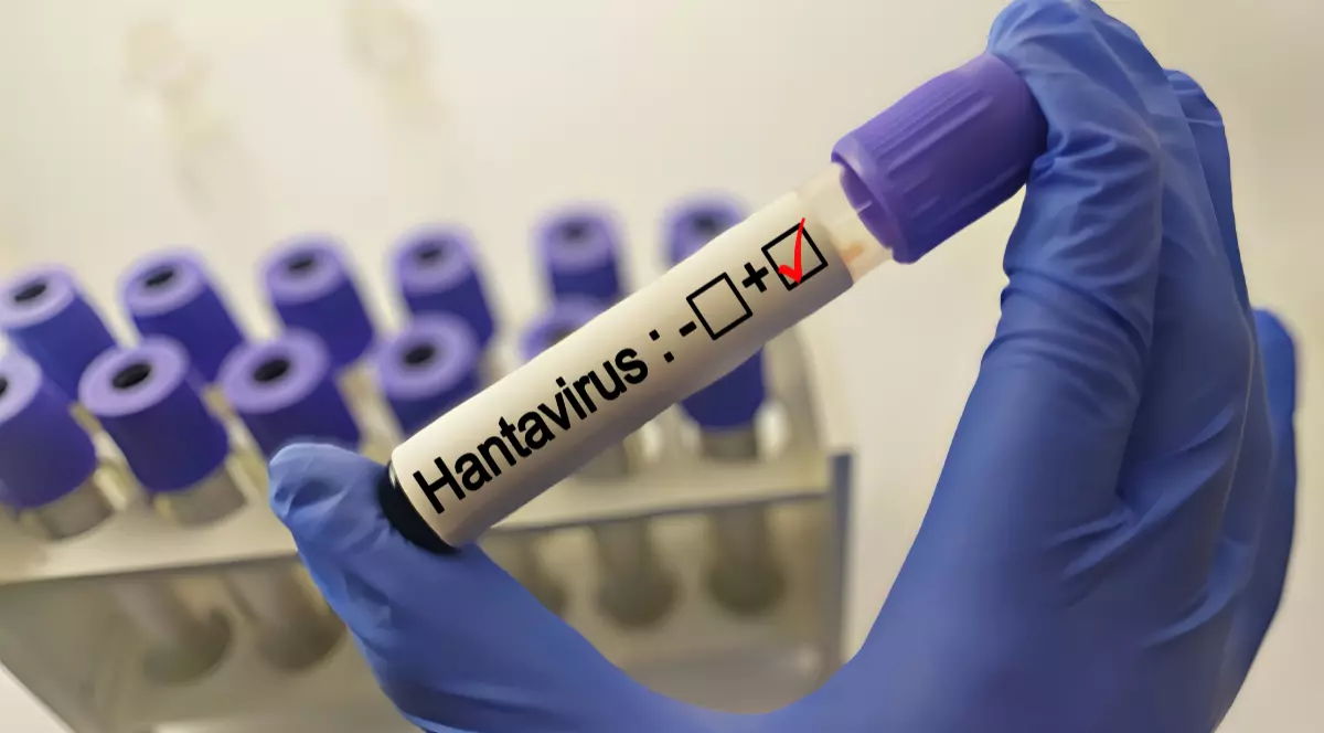 O epubretă pe care scrie Hantavirus