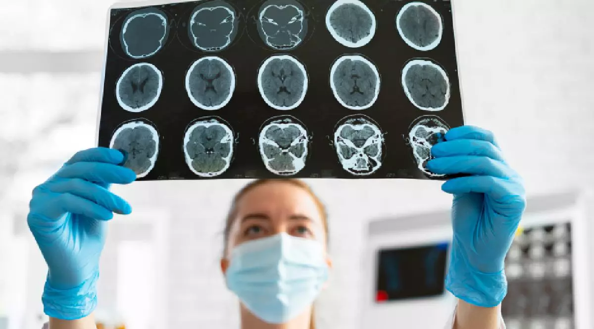 O femeie cu masca si cu manusi,cadru medical priveste la o radiografie cu creiere. Traumatisme craniene