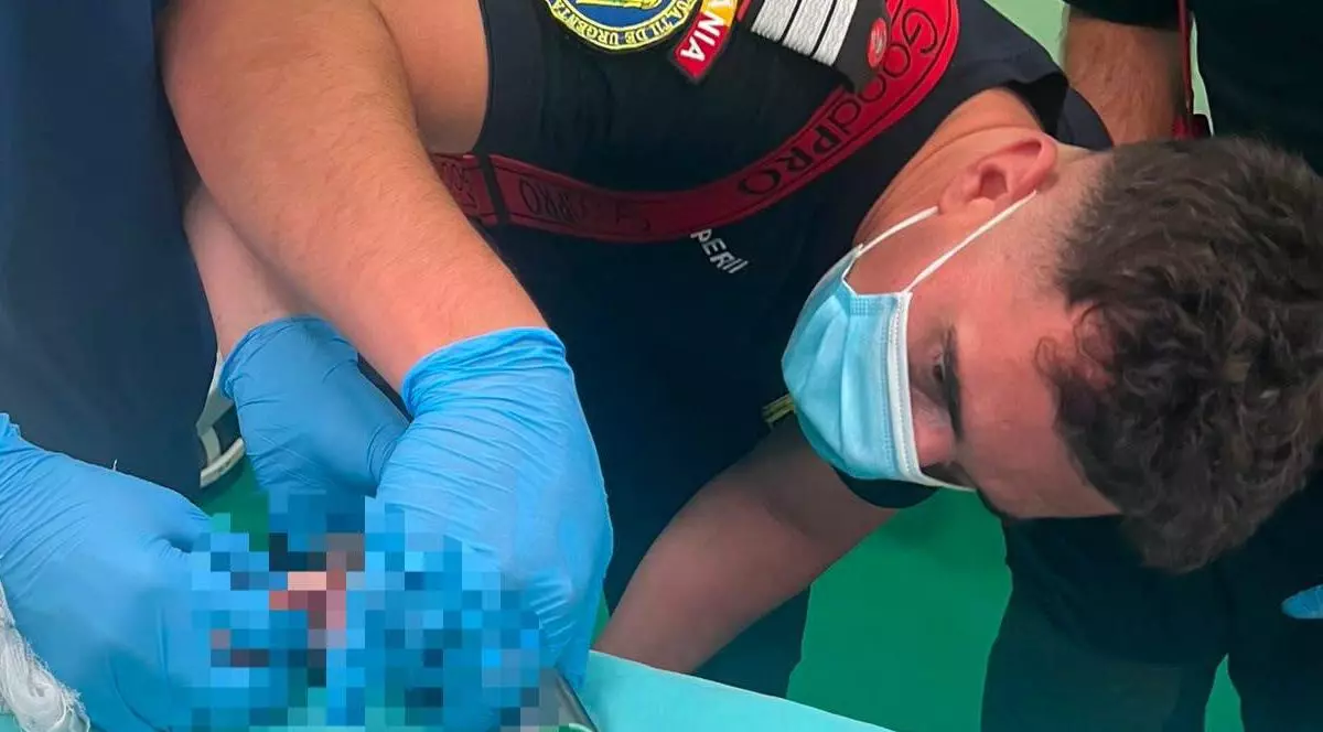 Un copil de doar doi ani a ajuns la spital cu mâna prinsă într-o mașină de tocat. Ce au fost nevoiți pompierii să facă în sala de operație. Sursă foto: Facebook/DSU.