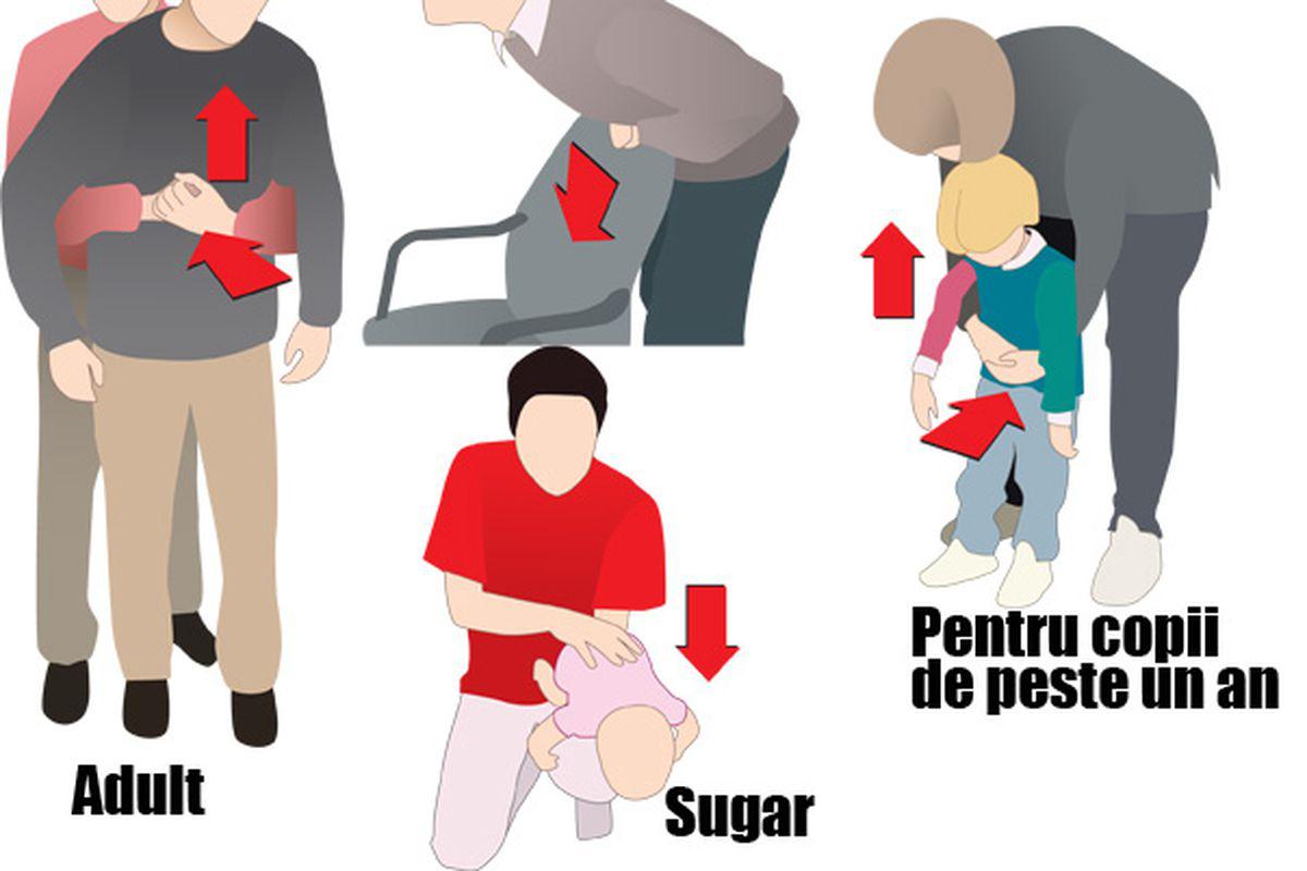 Stii Ce Să Faci Dacă Te Ineci Cu Mancare Lifestyle Sănătate și Fitness Libertatea Libertatea