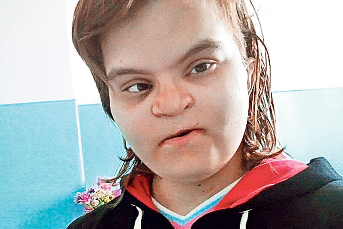 Andreea Are Nevoie De 500 Fata Cu Buză De Iepure Trebuie Să