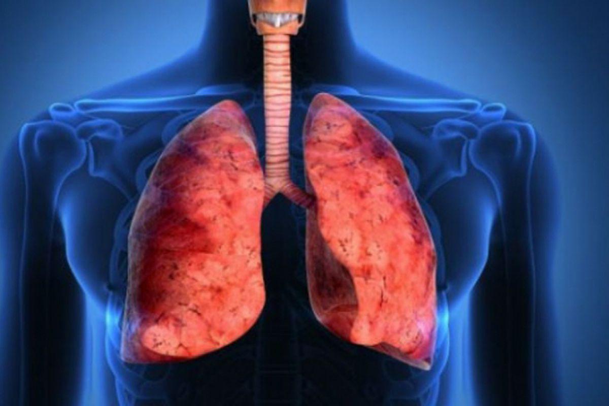 Iată Care Sunt Cele Mai Bune Alimentele Care Iți Curăță Plămanii Lifestyle Sănătate și Fitness Libertatea Libertatea