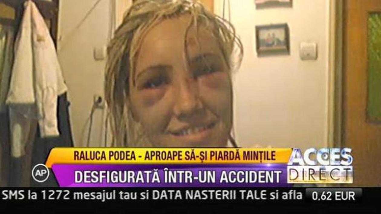 "Mi se spunea păpuşa Chucky". DRAMA UNEI VEDETE care S-A TEMUT că nu se mai poate PRIVI ÎN OGLINDĂ