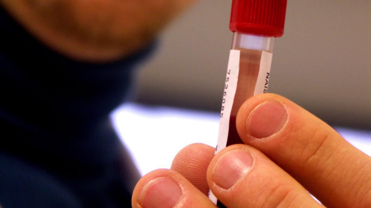 AI ACEST ANTIGEN ÎN SÂNGE? S-a descoperit că e de PROVENIENŢĂ EXTRATERESTRĂ