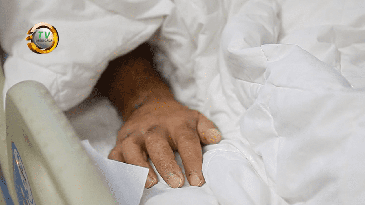 Povestea primului pacient COVID salvat cu un plămân artificial, la Timișoara: un bărbat cu 13 copii, care nu credea în existența virusului