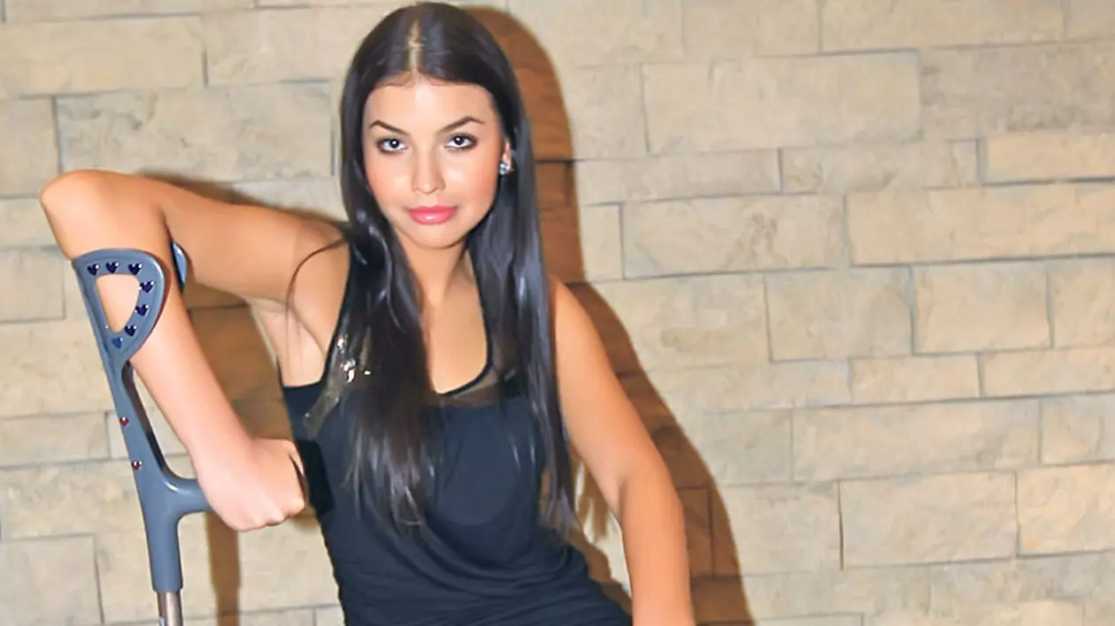 Miss România, în cârje: are ruptură de ligamente