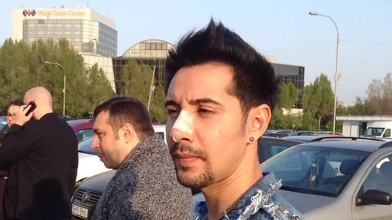 Adi Cristescu a apărut la ZU Music Awards CU NASUL PANSAT