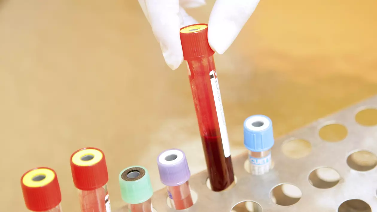 PRIMUL PACIENT VINDECAT DE HIV/SIDA! Ce au descoperit medicii este uimitor