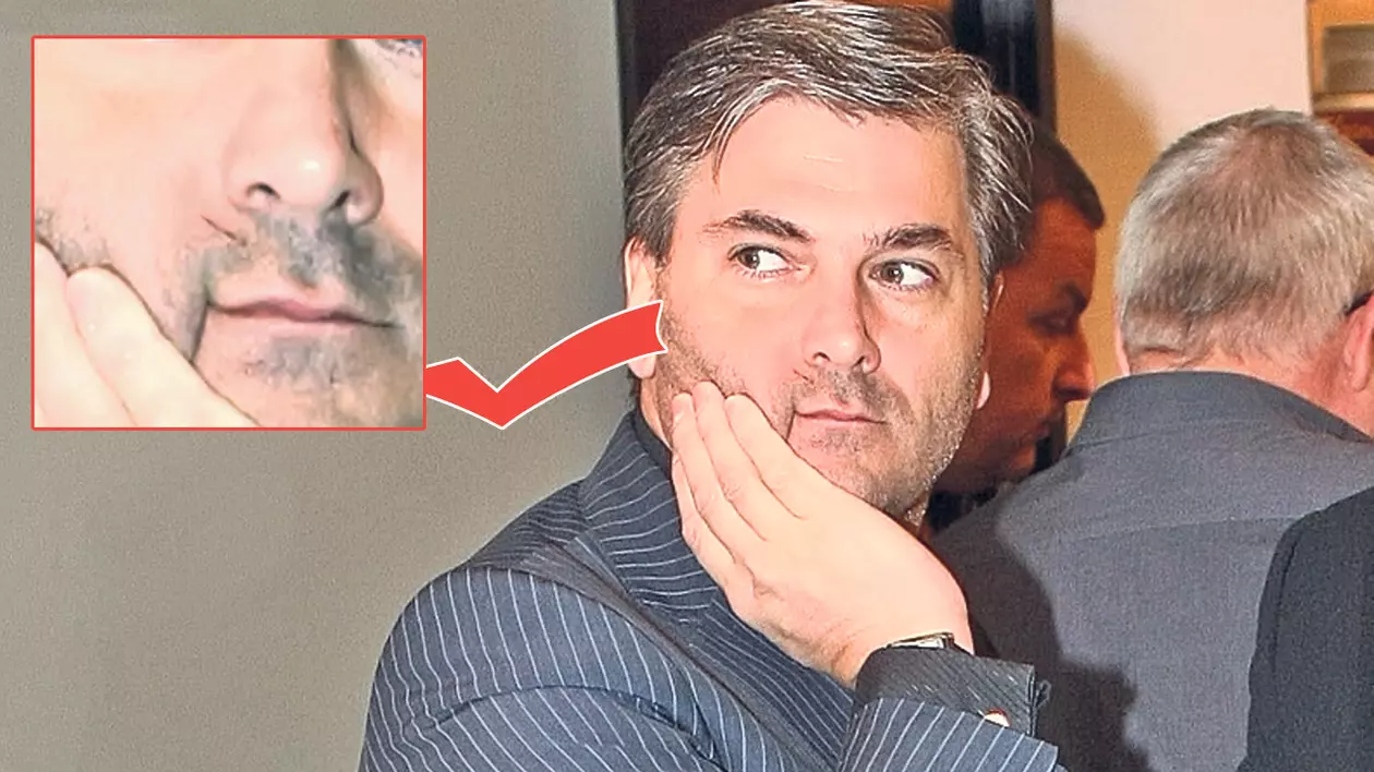 EXCLUSIV | Mircea Radu se rade periculos!