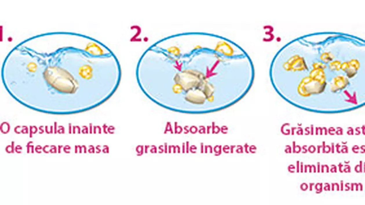 (P) Pastila de slabit care se transforma in balon gastric, lansata in Romania!