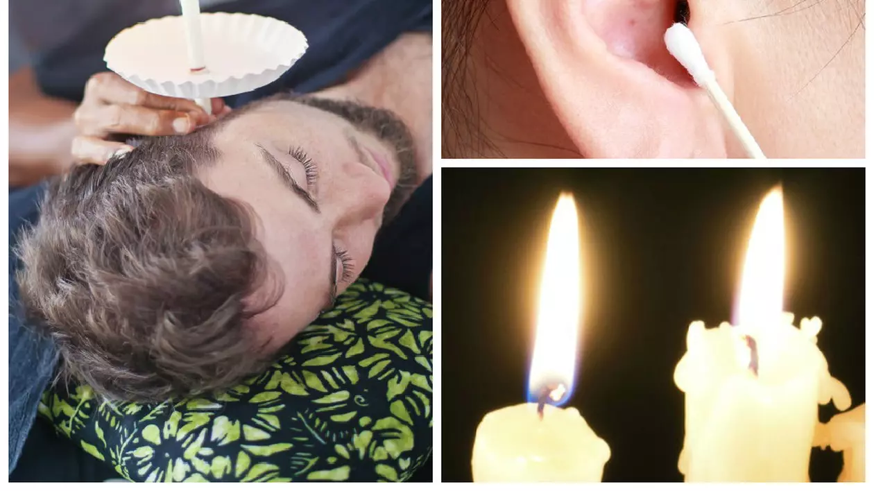 Cum scoţi ceara din ureche cu o lumânare | Video