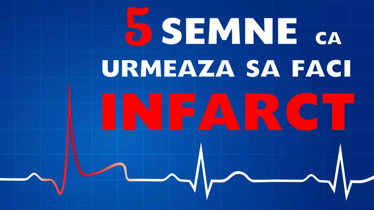 Semne că vei face infarct