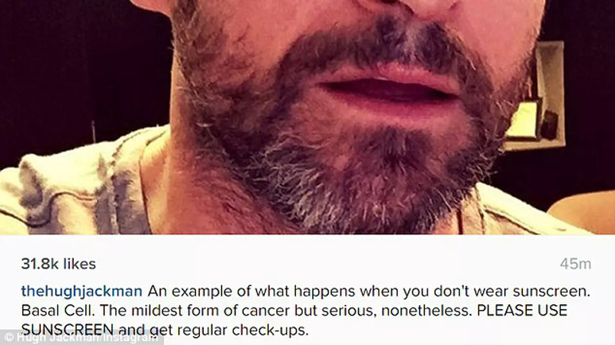 Hugh Jackman,  operat a cincea oară de cancer de piele! Apel către fani!