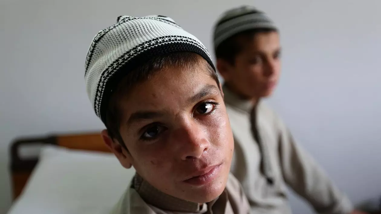 Caz bizar în Pakistan. Doi fraţi normali ziua paralizează complet noaptea. Ce spun medicii