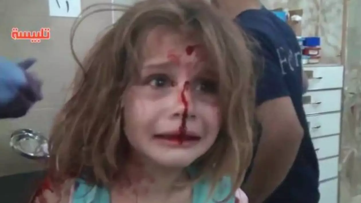 Înregistrare dramatică | Momentul în care o fetiță din Siria, rănită în urma unui raid aerian, strigă după tatăl ei