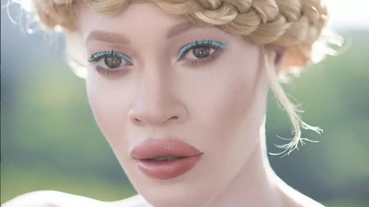 Diandra Forrest este primul fotomodel afro-american albinos