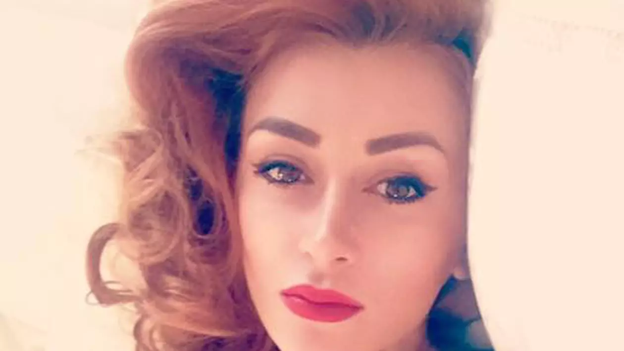 Denisa Tănase de la Bambi s-a botoxat. Cum arată la 3 zile după tratament