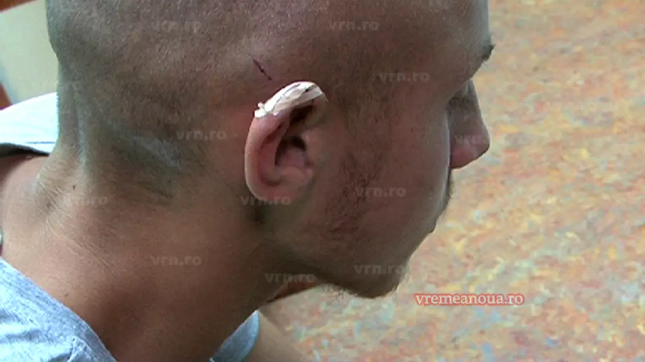 Un profesor din Vaslui i-a rupt urechea unul elev