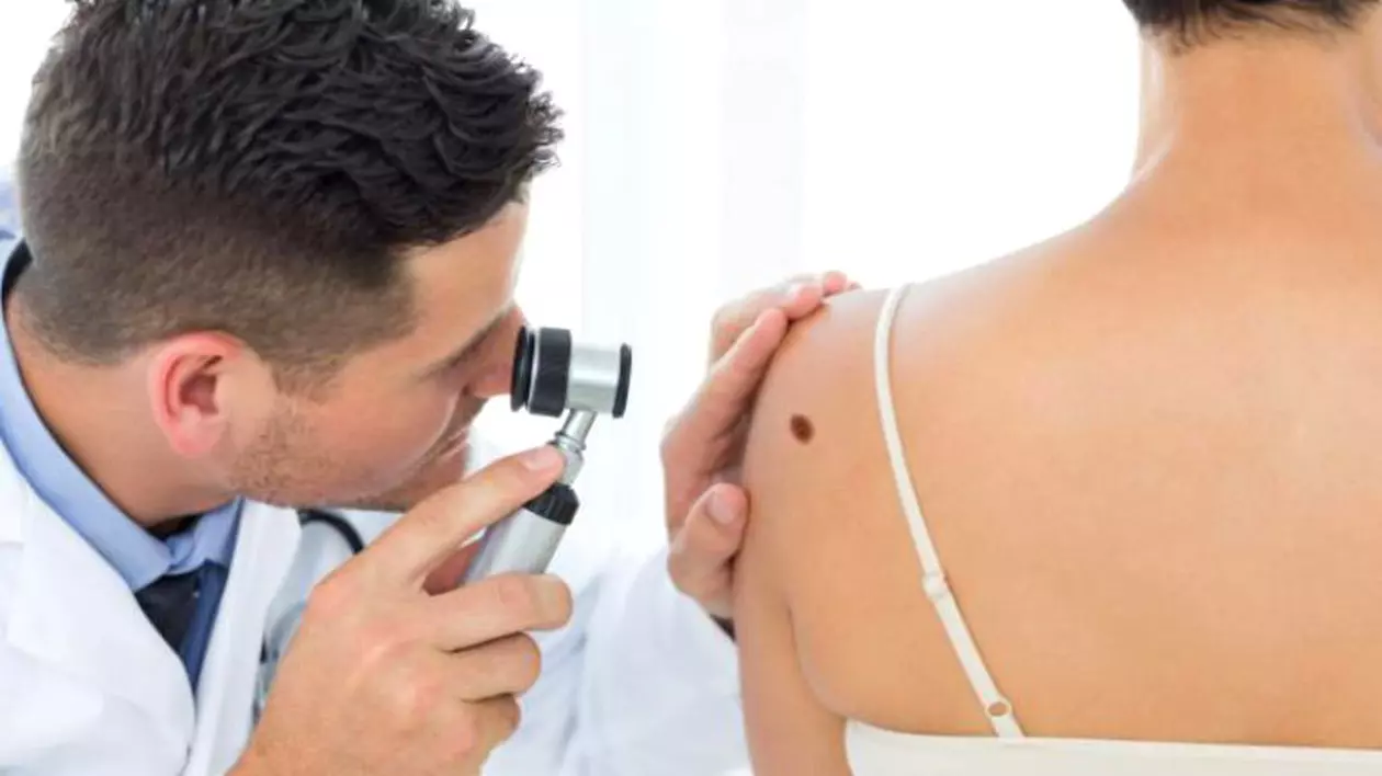 Mihaela Leventer. Medic dermatolog care verifică o aluniță