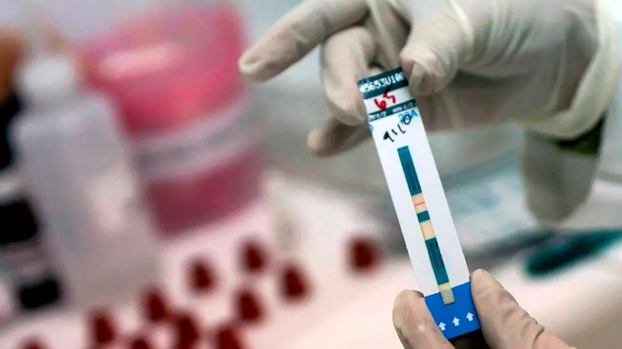 Virusul HIV, eliminat cu ajutorul transplantului de celule stem