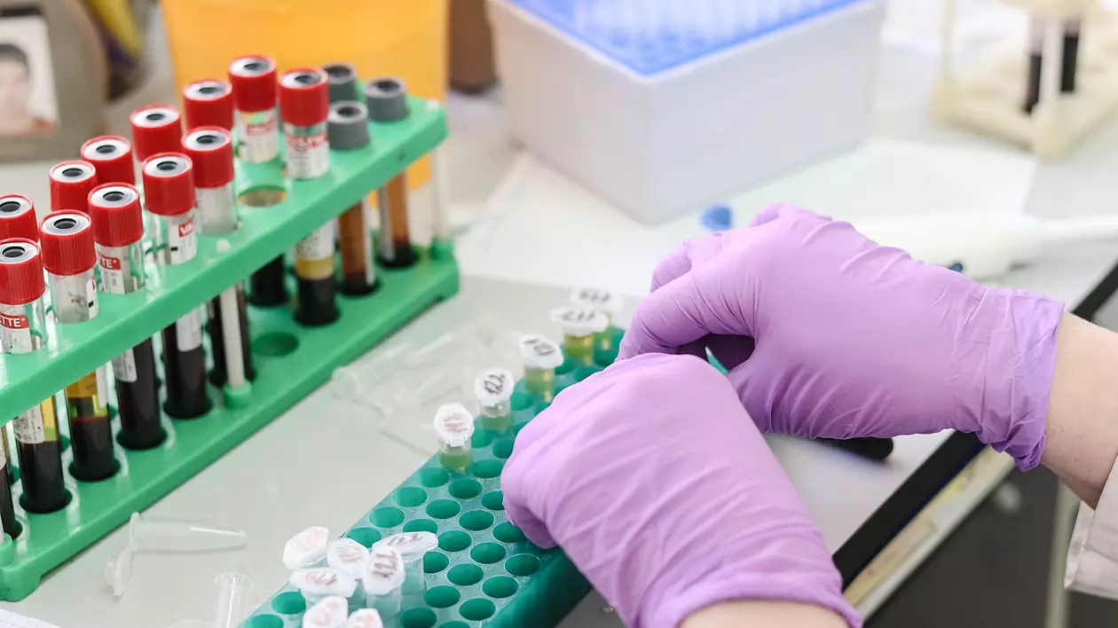 Colegiul Fizicienilor Medicali din Romania a făcut publică lista celor opt falși fizicieni care lucrează în spitale publice sau private din România, fără să aibă studii de specialitate. Printre aceștia se numără și fiica directorului medical al Spitalului din Roșiorii de Vede care a fost trimis în judecată de procurorii DNA pentru abuz în serviciu